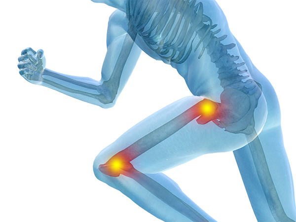 The Connection Between Hip and Knee Pain